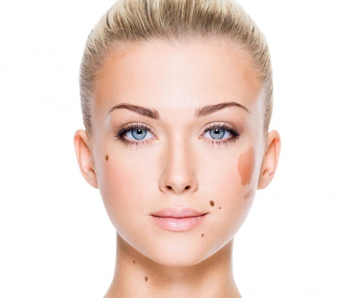 Yüzünüzde Ortaya Çıkan ve Sağlık Sorunları Yaşadığınıza İşaret Eden 11 Belirti