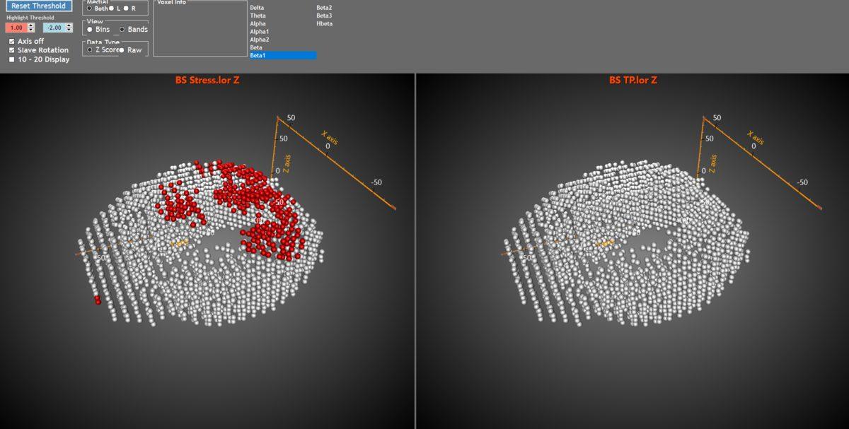 CES Fuarında Stres Azaltan Titreşimli Bileklik: Touchpoints
