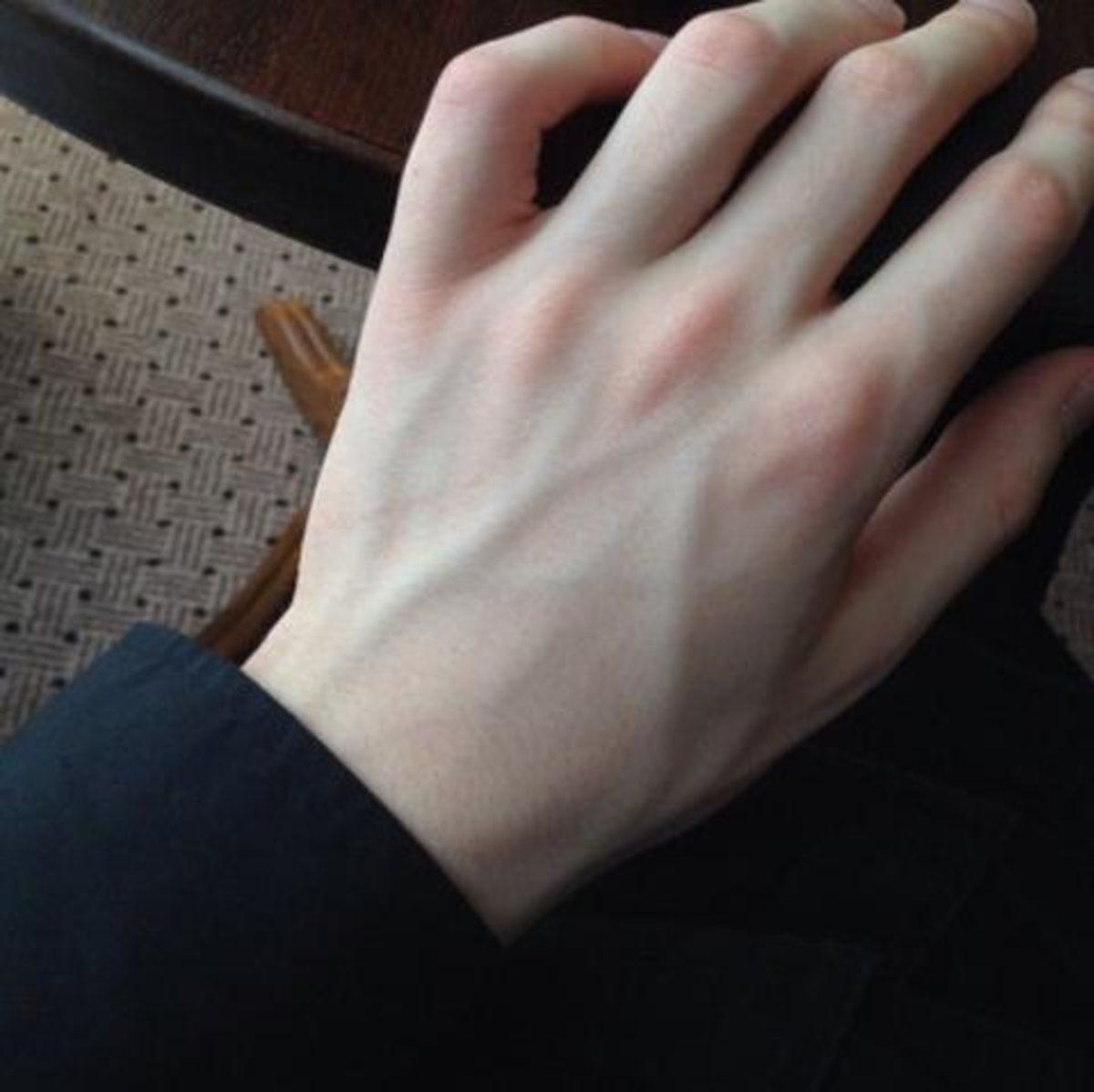 Kanımız Kırmızı Olduğu Halde Damarlarımızı Neden Mavi Renkte Görüyoruz?