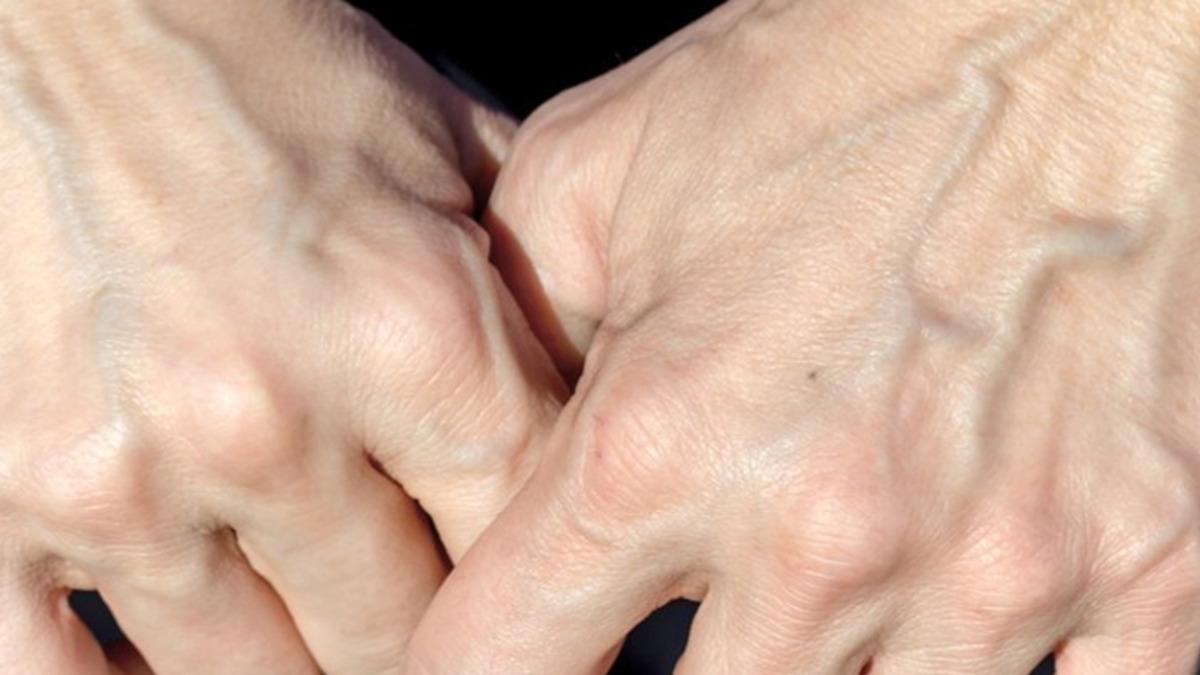 Kanımız Kırmızı Olduğu Halde Damarlarımızı Neden Mavi Renkte Görüyoruz?