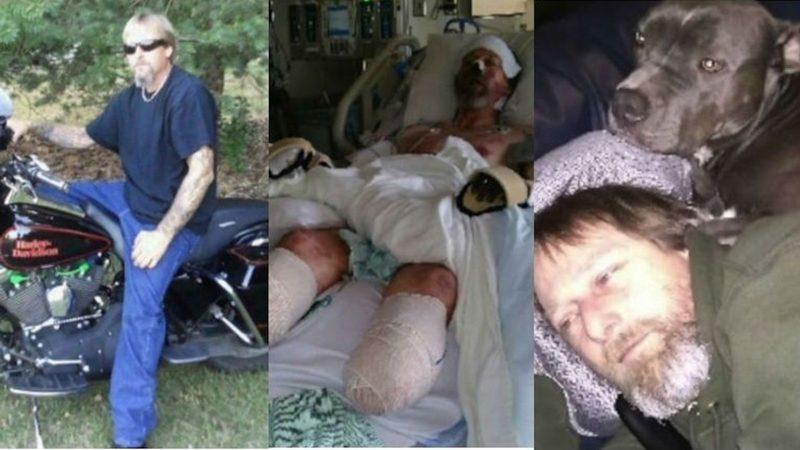 Elini Yalayan Köpeğinden Virüs Kapan Adam, Kollarını ve Bacaklarını Kaybetti