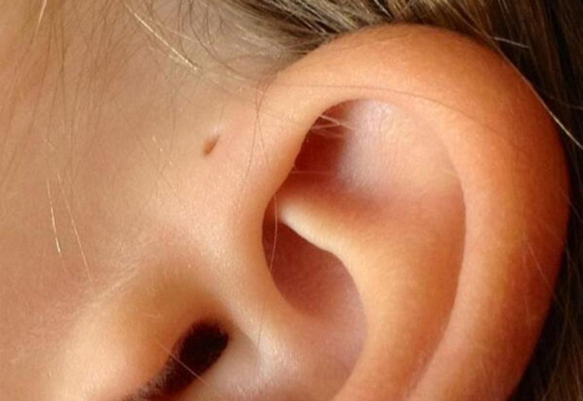 Bazı İnsanların Kulaklarında Doğuştan Bulunan Delikler Ne Anlama Geliyor?