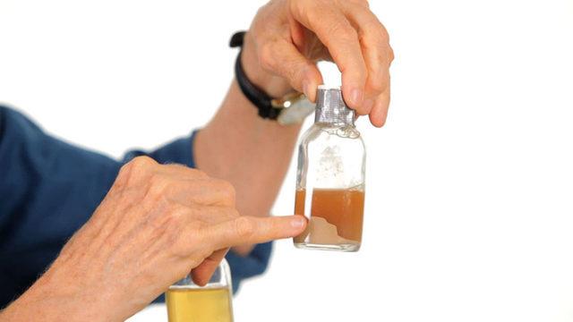 İdrarınızın Renginin, Sağlığınız İçin Ne Anlam İfade Ettiğini Biliyor musunuz?