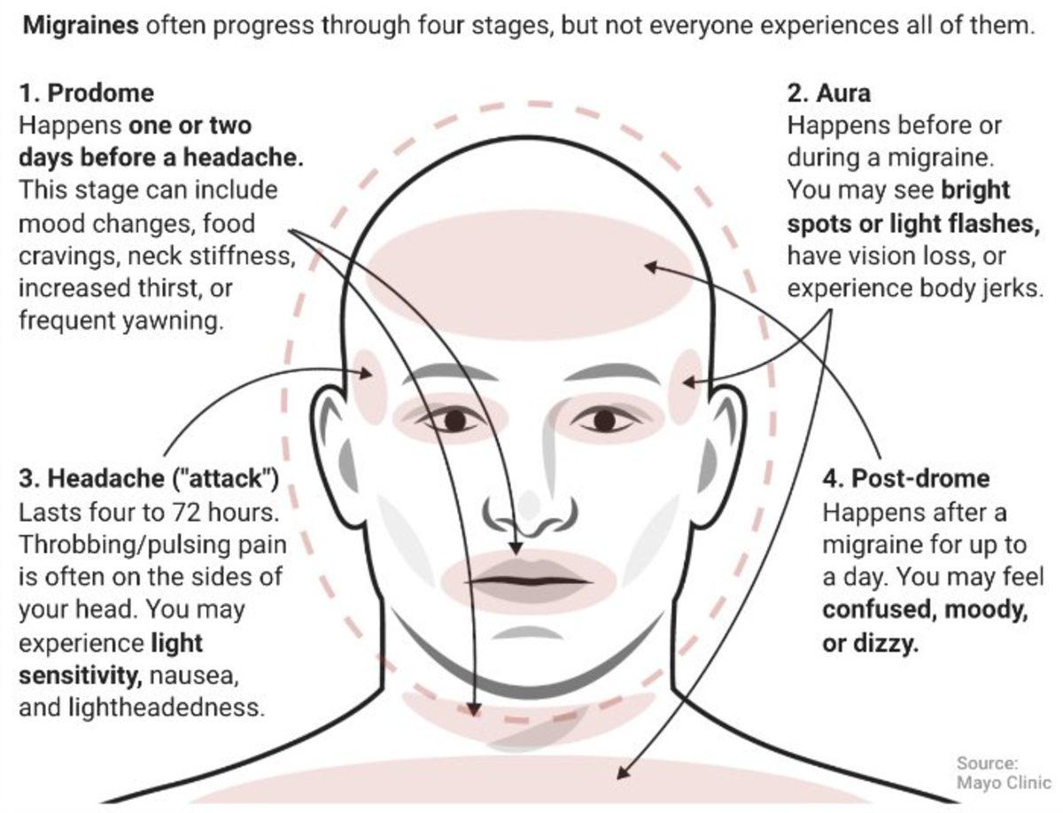En Yaygın 3 Baş Ağrısı Türünün Sebebi ve Hissedildiği Bölgeler