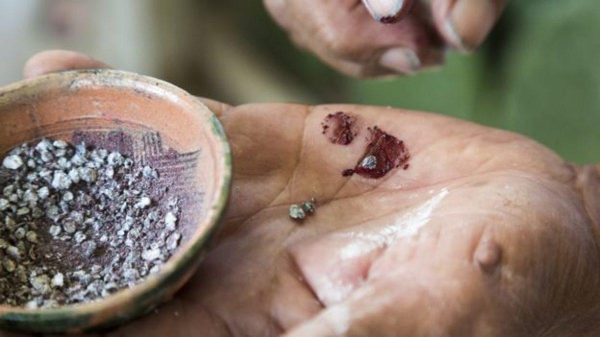 Türkiye’de Satılan İçecek ve Yiyeceklerin Hemen Hepsinde Bulunan Böcek