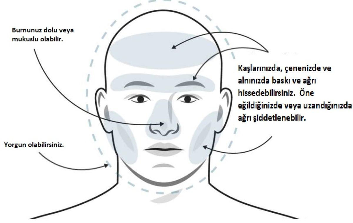 Baş Ağrınızın Sebebinin Migren Olup Olmadığını Nasıl Anlarsınız?