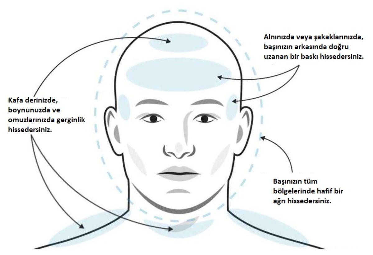 Baş Ağrınızın Sebebinin Migren Olup Olmadığını Nasıl Anlarsınız?