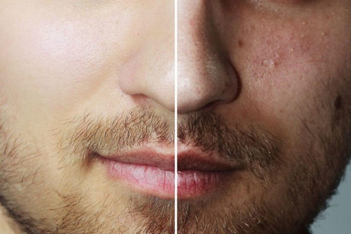 Bir Ay Boyunca Hiç Tuz Kullanmazsanız Ne Olur?