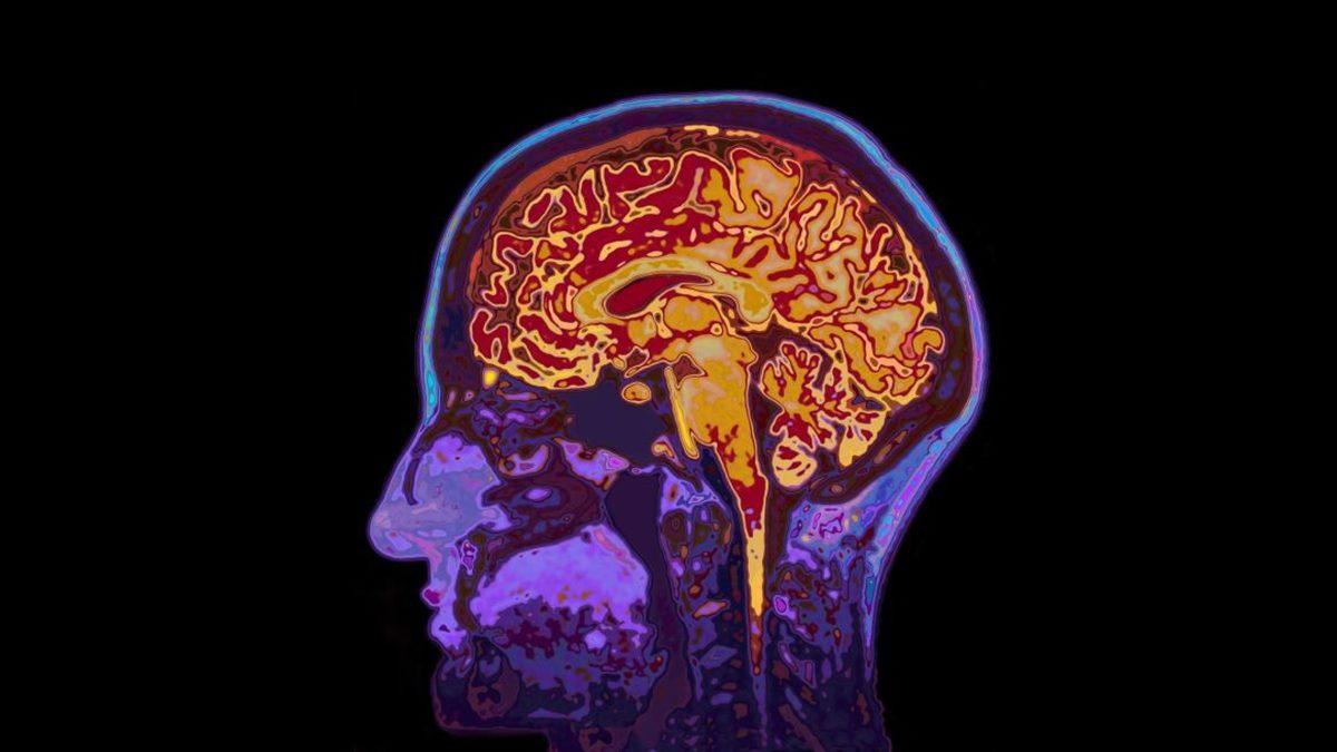 Ben Bunu Bir Yerden Hatırlıyorum: Deja Vu Neden Olur?