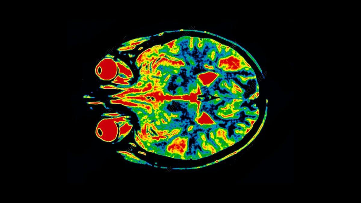 Ben Bunu Bir Yerden Hatırlıyorum: Deja Vu Neden Olur?