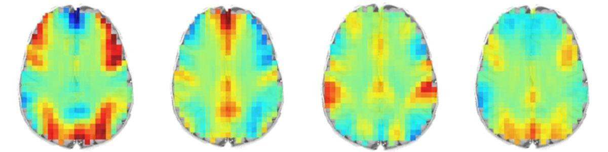 Matematik Problemi Çözdüğümüz Esnada Beynimiz Nasıl Görünüyor?