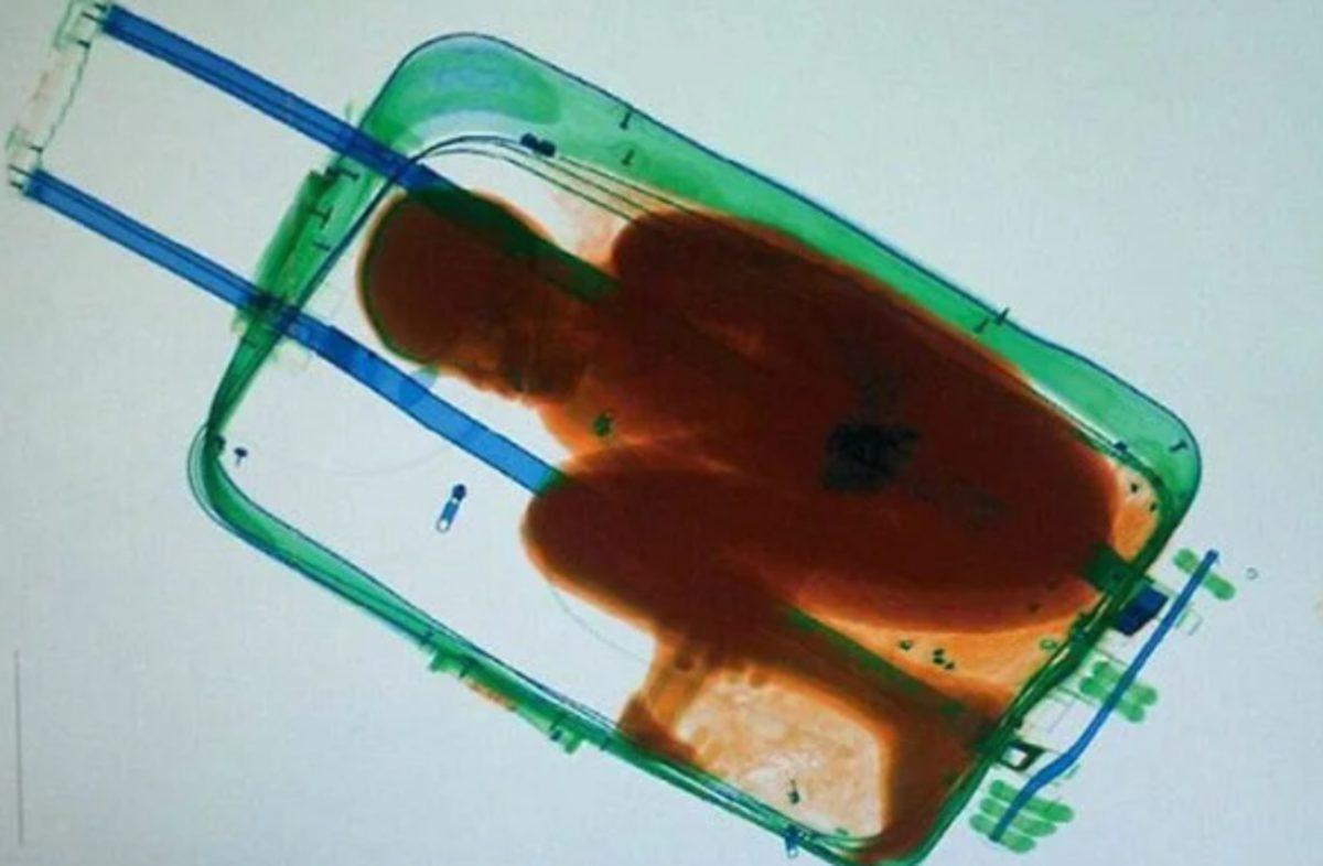 Havalimanlarında Yolcuların Bagajlarından Çıkmış 12 Garip Şey