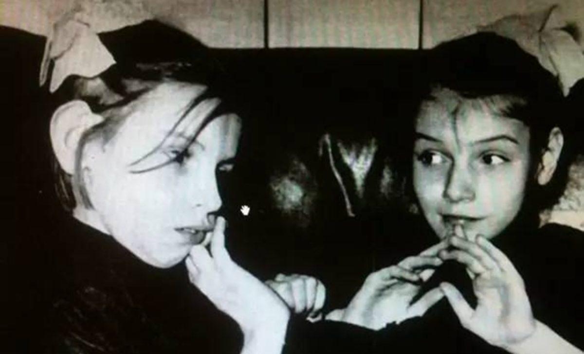 Bilim Adı Altında Birçok İşkenceye Maruz Bırakılmış Yapışık İkizlerin Yürek Burkan Hikayesi