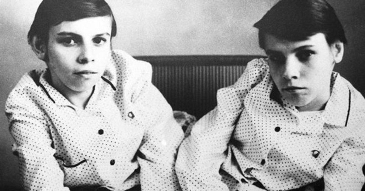 Bilim Adı Altında Birçok İşkenceye Maruz Bırakılmış Yapışık İkizlerin Yürek Burkan Hikayesi