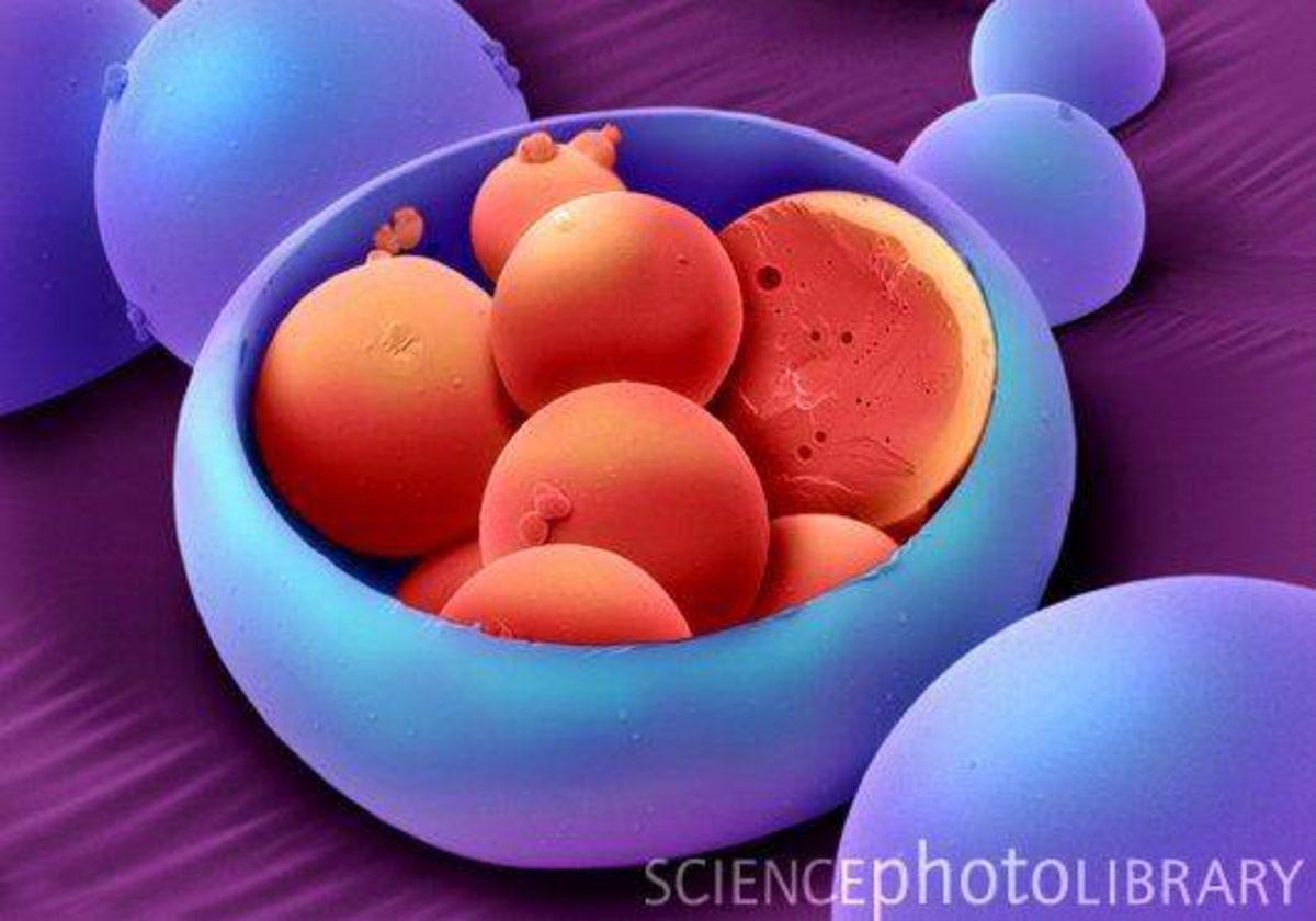 Elektron Mikroskobu ile Çekilmiş Birbirinden İlginç 27 Fotoğraf