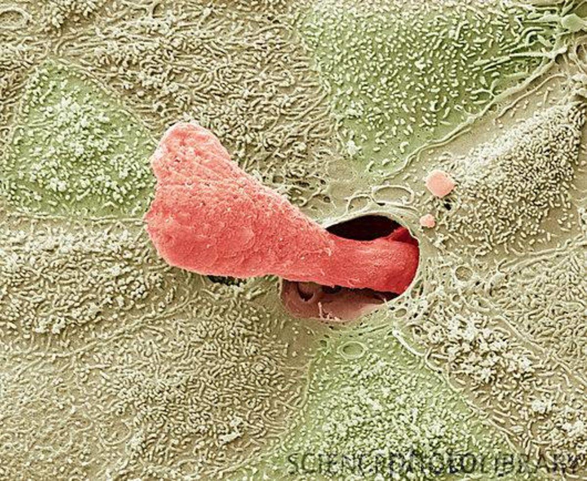 Elektron Mikroskobu ile Çekilmiş Birbirinden İlginç 27 Fotoğraf