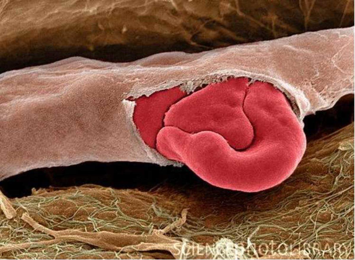 Elektron Mikroskobu ile Çekilmiş Birbirinden İlginç 27 Fotoğraf