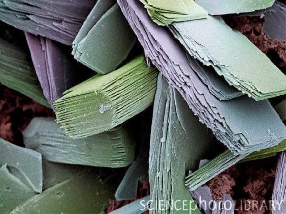 Elektron Mikroskobu ile Çekilmiş Birbirinden İlginç 27 Fotoğraf