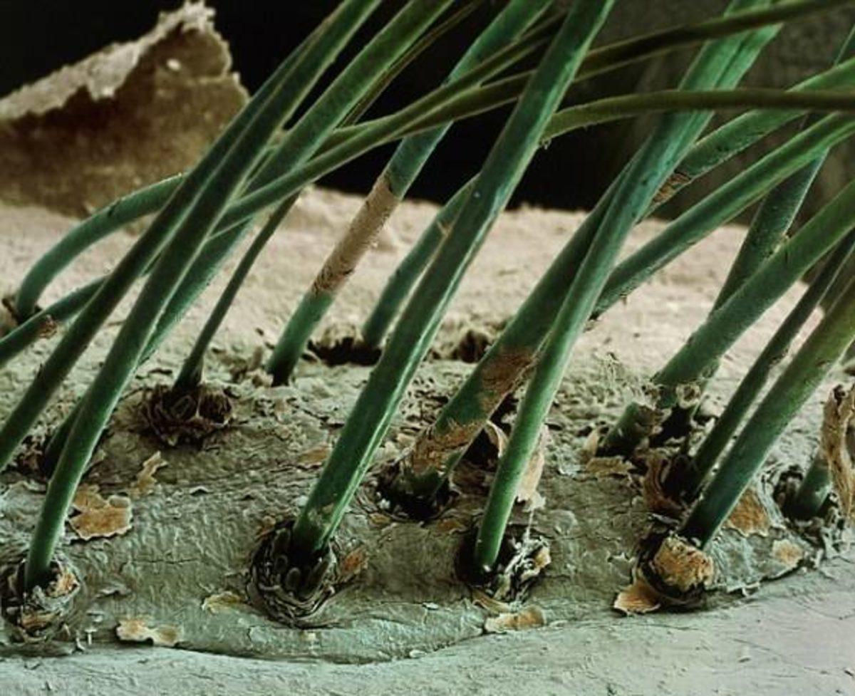 Elektron Mikroskobu ile Çekilmiş Birbirinden İlginç 27 Fotoğraf