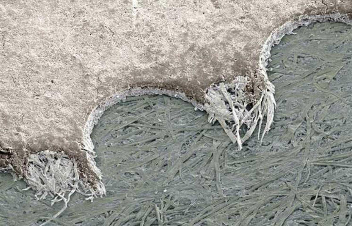 Elektron Mikroskobu ile Çekilmiş Birbirinden İlginç 27 Fotoğraf