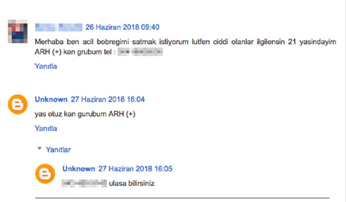 Bu Kez Şakası Yok: Türkiye’de Satılık Böbrek İlanı Artıyor