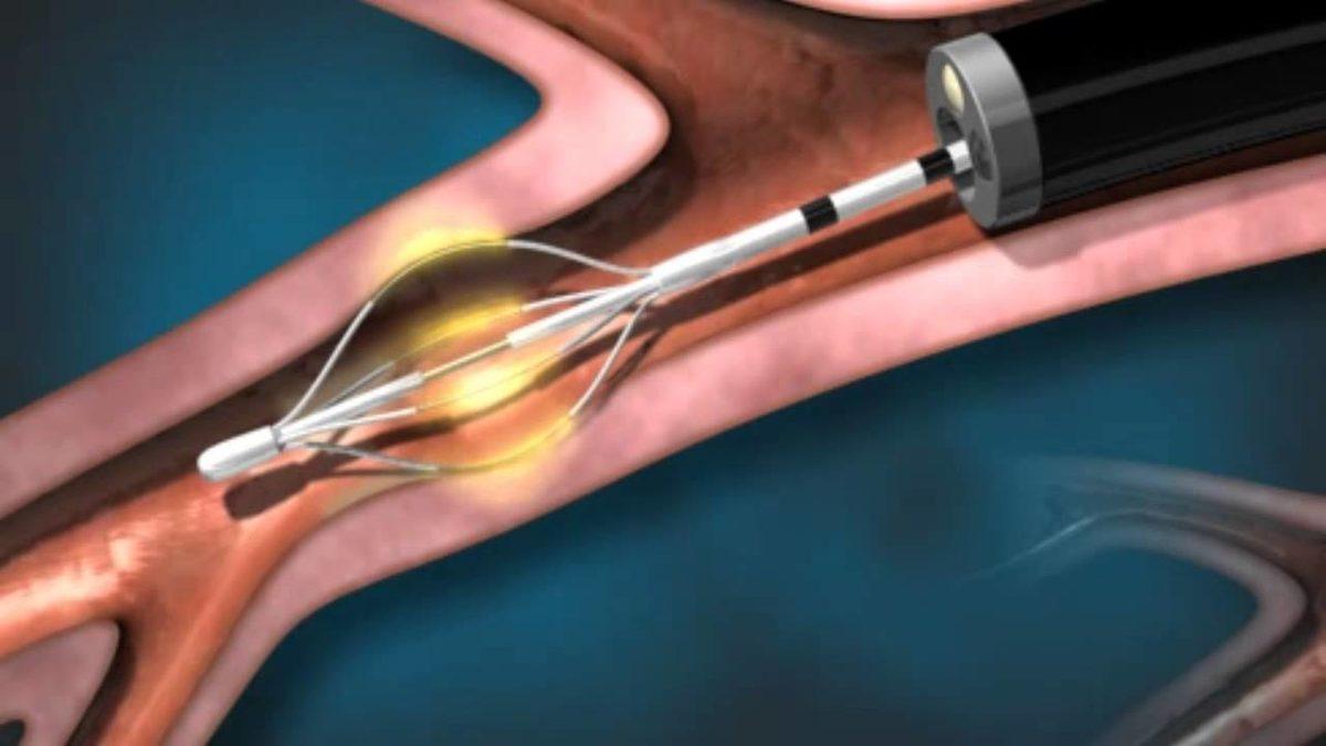 Tıp ve Teknolojinin Bir Araya Geldiği, Hayat Değiştiren 11 Buluş (Video)