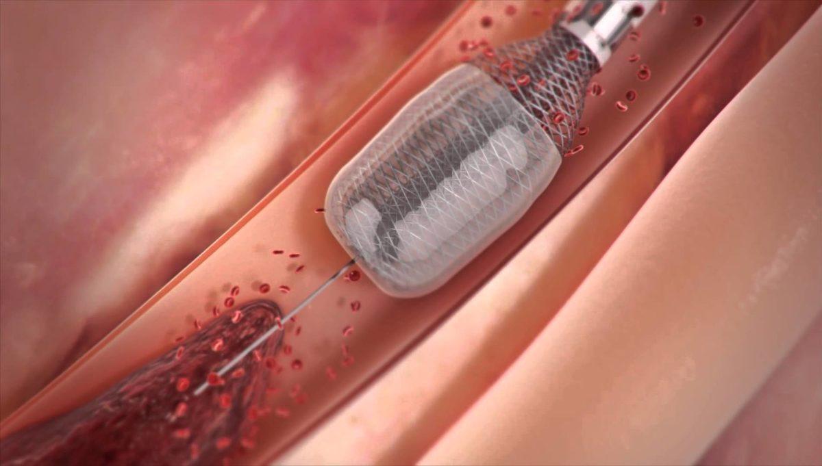 Tıp ve Teknolojinin Bir Araya Geldiği, Hayat Değiştiren 11 Buluş (Video)