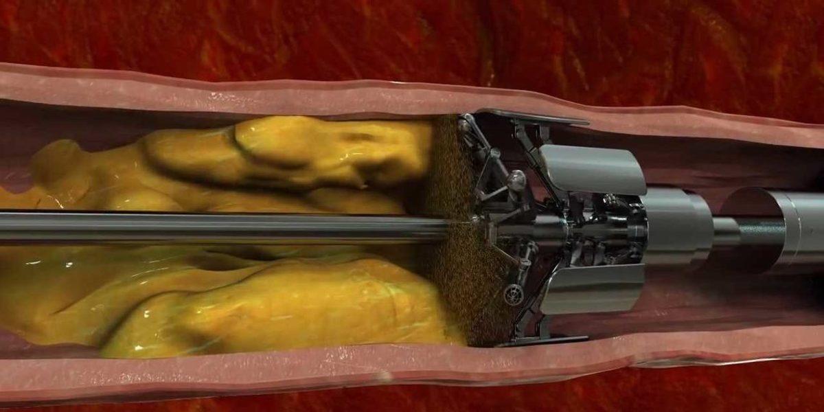 Tıp ve Teknolojinin Bir Araya Geldiği, Hayat Değiştiren 11 Buluş (Video)