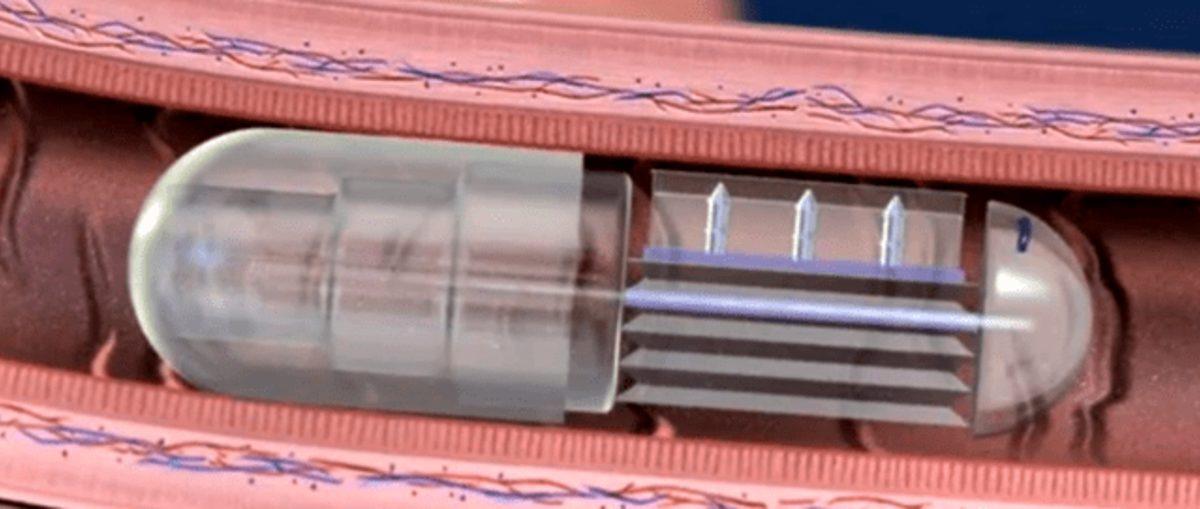 Tıp ve Teknolojinin Bir Araya Geldiği, Hayat Değiştiren 11 Buluş (Video)