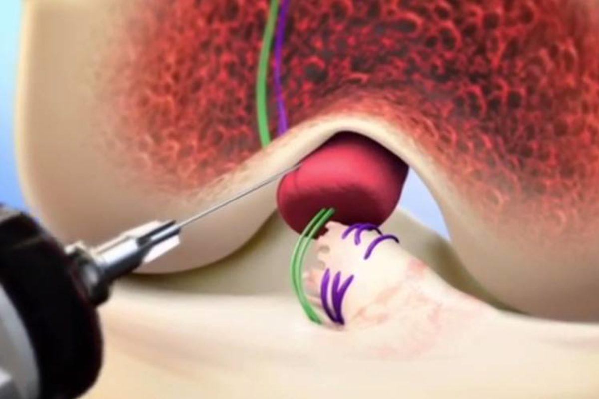 Tıp ve Teknolojinin Bir Araya Geldiği, Hayat Değiştiren 11 Buluş (Video)