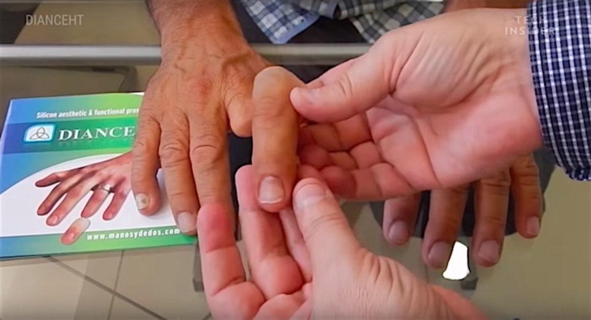 Tıp ve Teknolojinin Bir Araya Geldiği, Hayat Değiştiren 11 Buluş (Video)