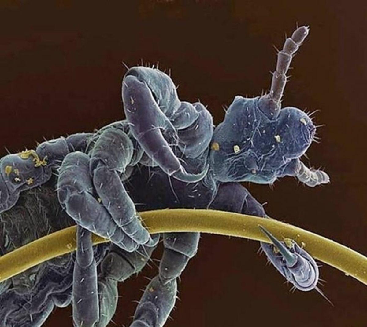 Her Gün Gördüğümüz 20 Nesnenin Mikroskop Altındaki İnanılmaz Görüntüleri