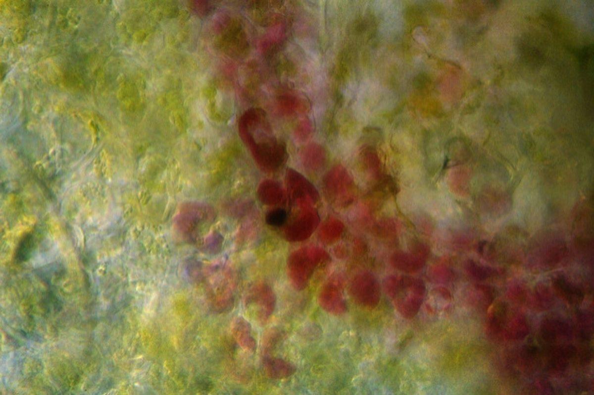 Her Gün Gördüğümüz 20 Nesnenin Mikroskop Altındaki İnanılmaz Görüntüleri