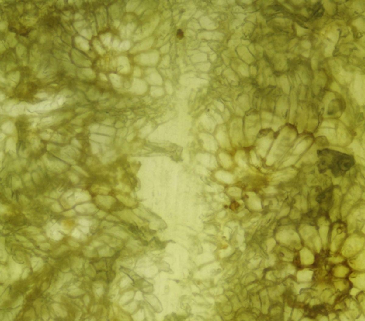 Her Gün Gördüğümüz 20 Nesnenin Mikroskop Altındaki İnanılmaz Görüntüleri