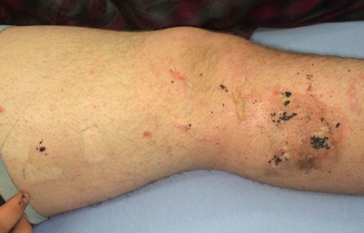 iPhone’un Patlamasıyla Odada Çıkan Yangının Sonu Kötü Oldu