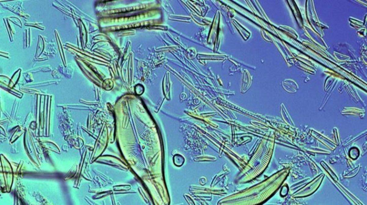 Günlük Hayatta Gördüğümüz Şeyler, Mikroskopla Nasıl Görünüyorlar?