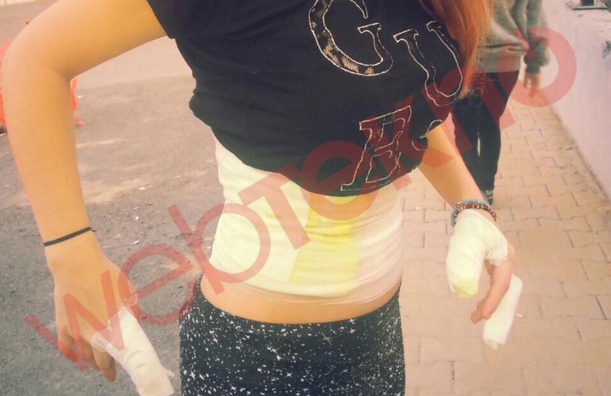 Samsung Galaxy S3 Yine Patladı!