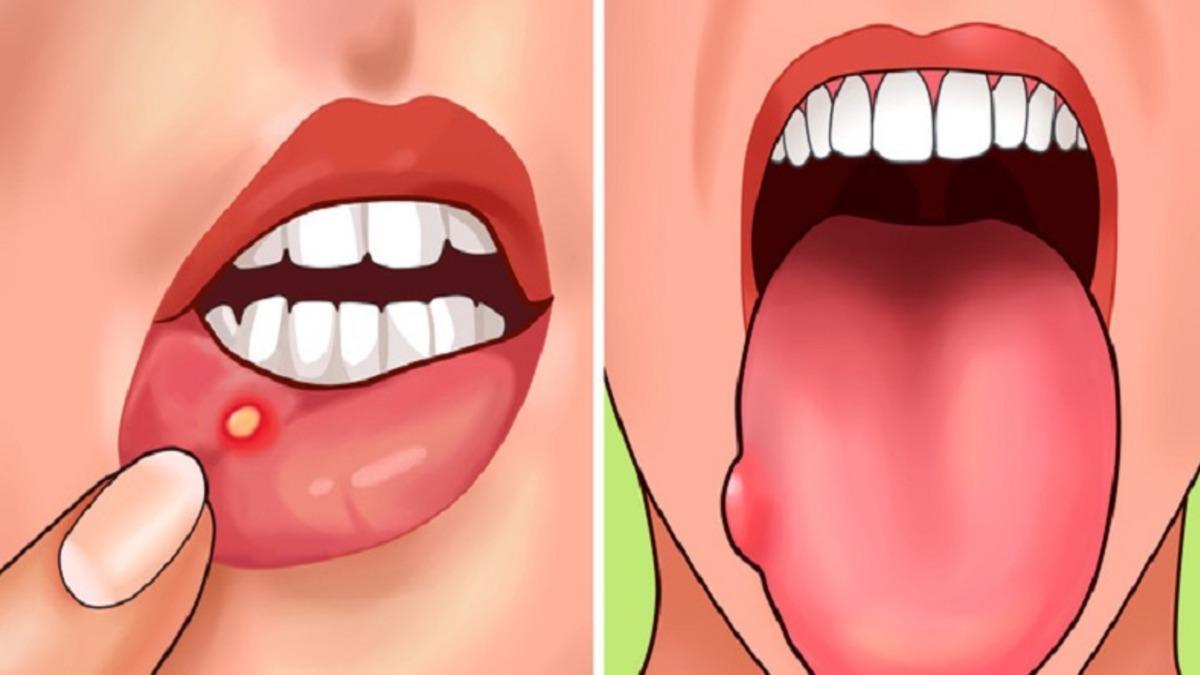 Vücudunuzun Folik Aside İhtiyacı Olduğunu Gösteren 7 Belirti