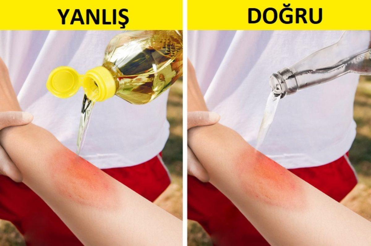 Acil Durumlarda Uygulayabileceğiniz 10 İlk Yardım Tekniği