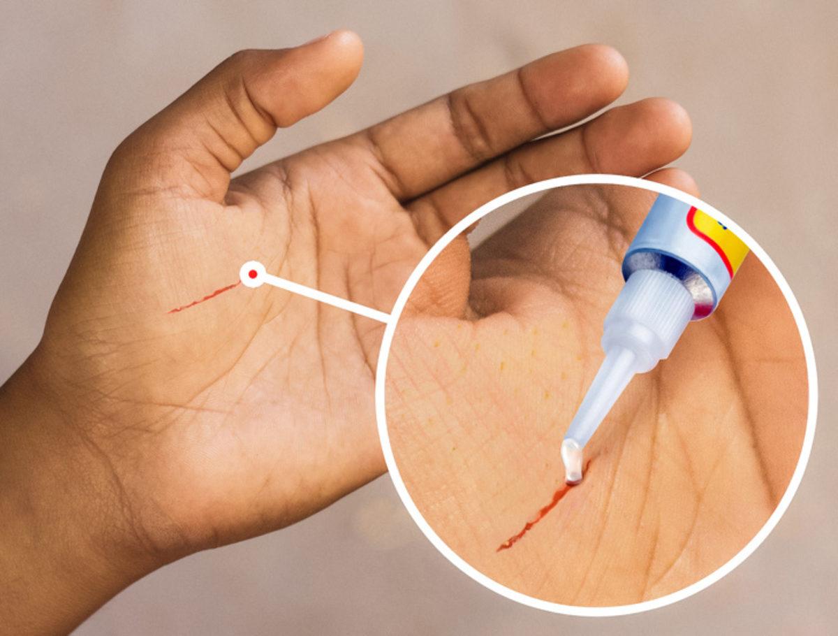 Acil Durumlarda Uygulayabileceğiniz 10 İlk Yardım Tekniği