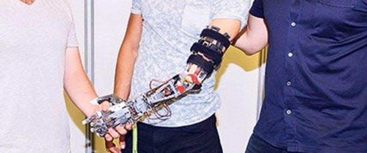 Türk Mühendislerden Bir Profesörümüzün Öve Öve Bitiremediği Yapay Zekalı Protez Kol