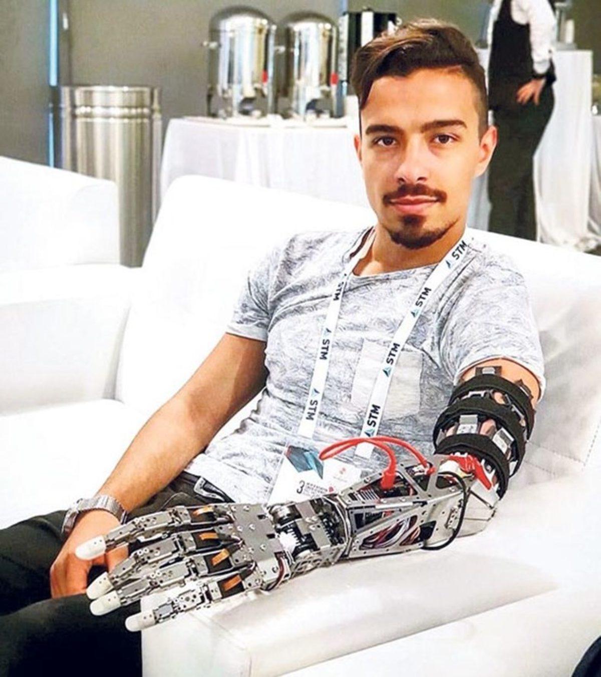 Türk Mühendislerden Bir Profesörümüzün Öve Öve Bitiremediği Yapay Zekalı Protez Kol