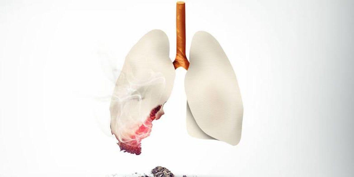30 Yıl Boyunca Her Gün 1 Paket Sigara İçen Adamın Akciğerinin İçler Acısı Son Hali
