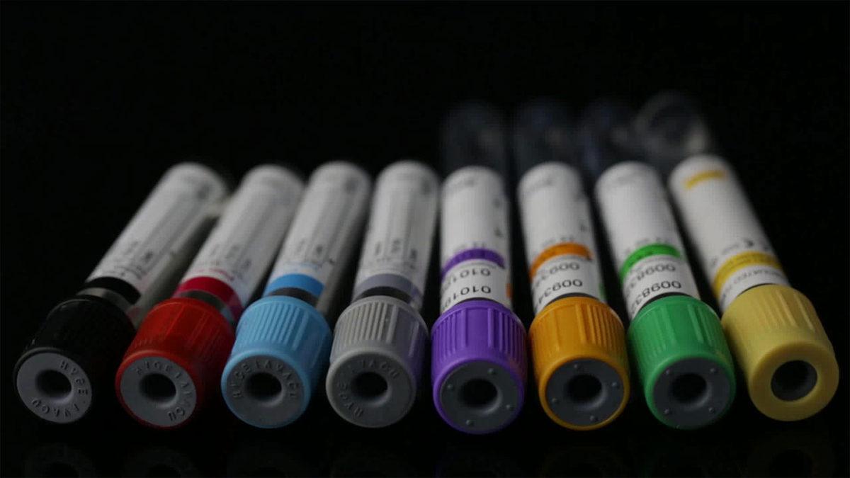 Anemi Hastalığını Teşhis Eden MCHC Nedir, Ne Anlama Gelir?