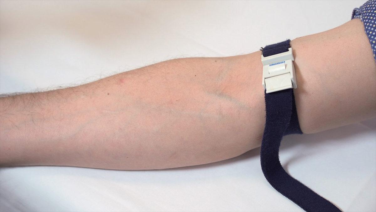 Anemi Hastalığını Teşhis Eden MCHC Nedir, Ne Anlama Gelir?