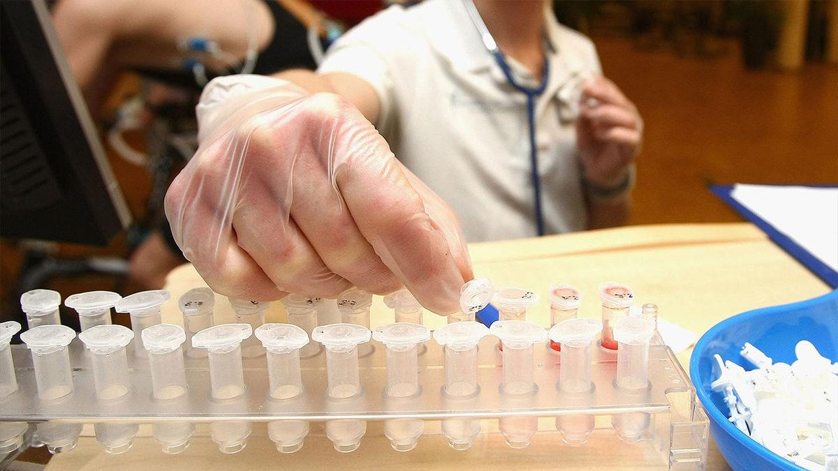 Anemi Hastalığını Teşhis Eden MCHC Nedir, Ne Anlama Gelir?