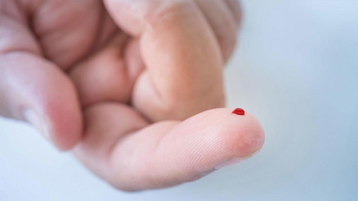 Anemi Hastalığını Teşhis Eden MCHC Nedir, Ne Anlama Gelir?