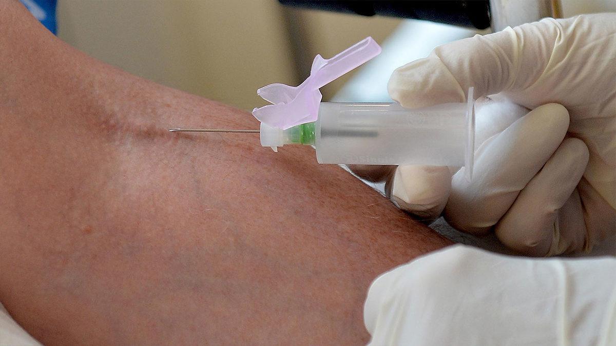 Anemi Hastalığını Teşhis Eden MCHC Nedir, Ne Anlama Gelir?