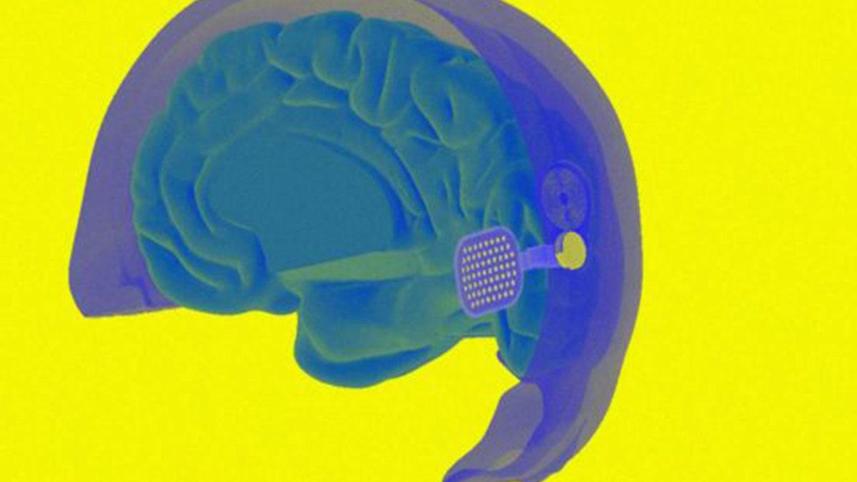 Bir Kişi, Biyonik Göz Sayesinde Kaybettiği Görme Yetisini Yeniden Kazandı