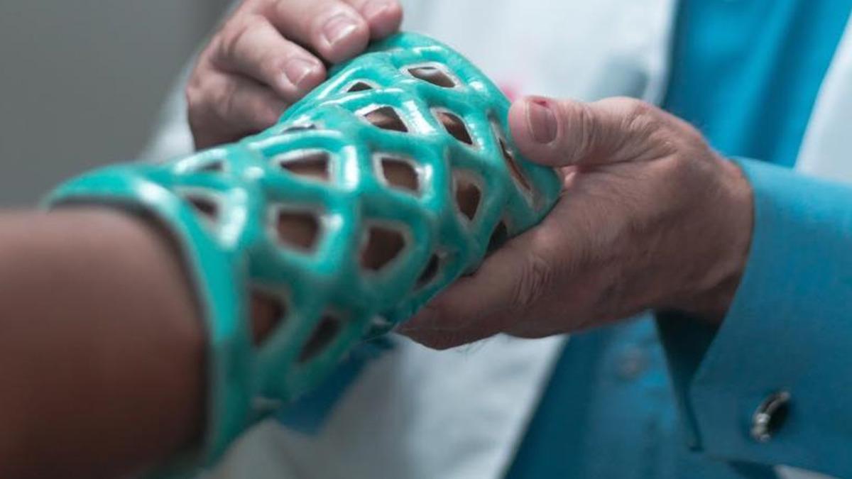 Kırık Tedavisinde Geleneksel Alçıyı Tarihe Gömecek Bir Alçı Kalıbı Geliştirildi